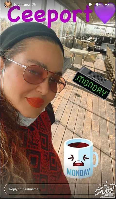 لب های پروتز و رژ لب نارنجی بهاره رهنما